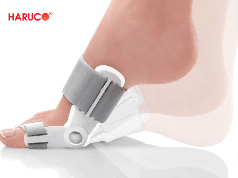 nep-chinh-hinh-ngon-chan-cai