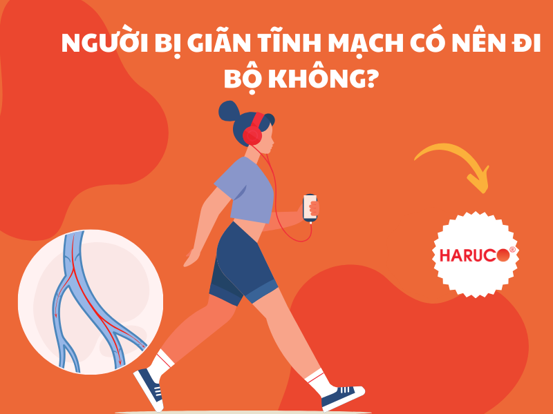 Người bị giãn tĩnh mạch có nên đi bộ không?