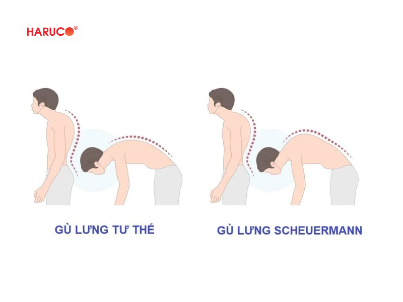 dai-lung-chong-gu-haruco