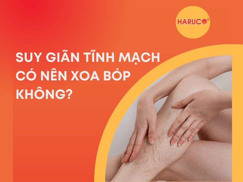 Suy giãn tĩnh mạch có nên xoa bóp không?