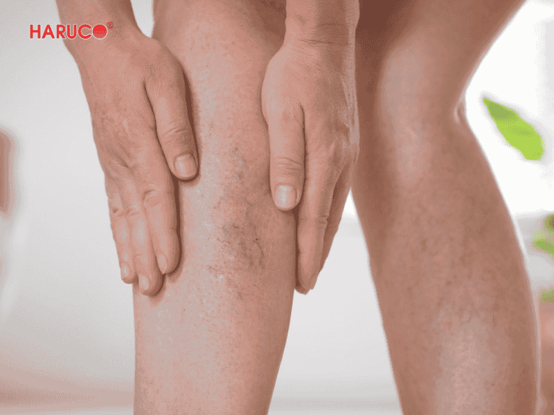 goi-ke-chan-gian-tinh-mach