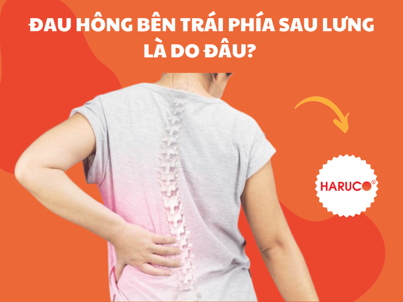 Đau hông bên trái phía sau lưng là do đâu? Nguyên nhân chính