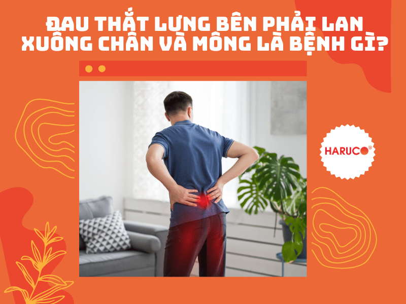 Đau thắt lưng bên phải lan xuống chân và mông là bệnh gì?