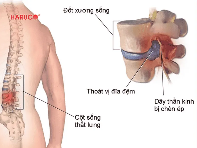 dai-lung-da-nong-haruco