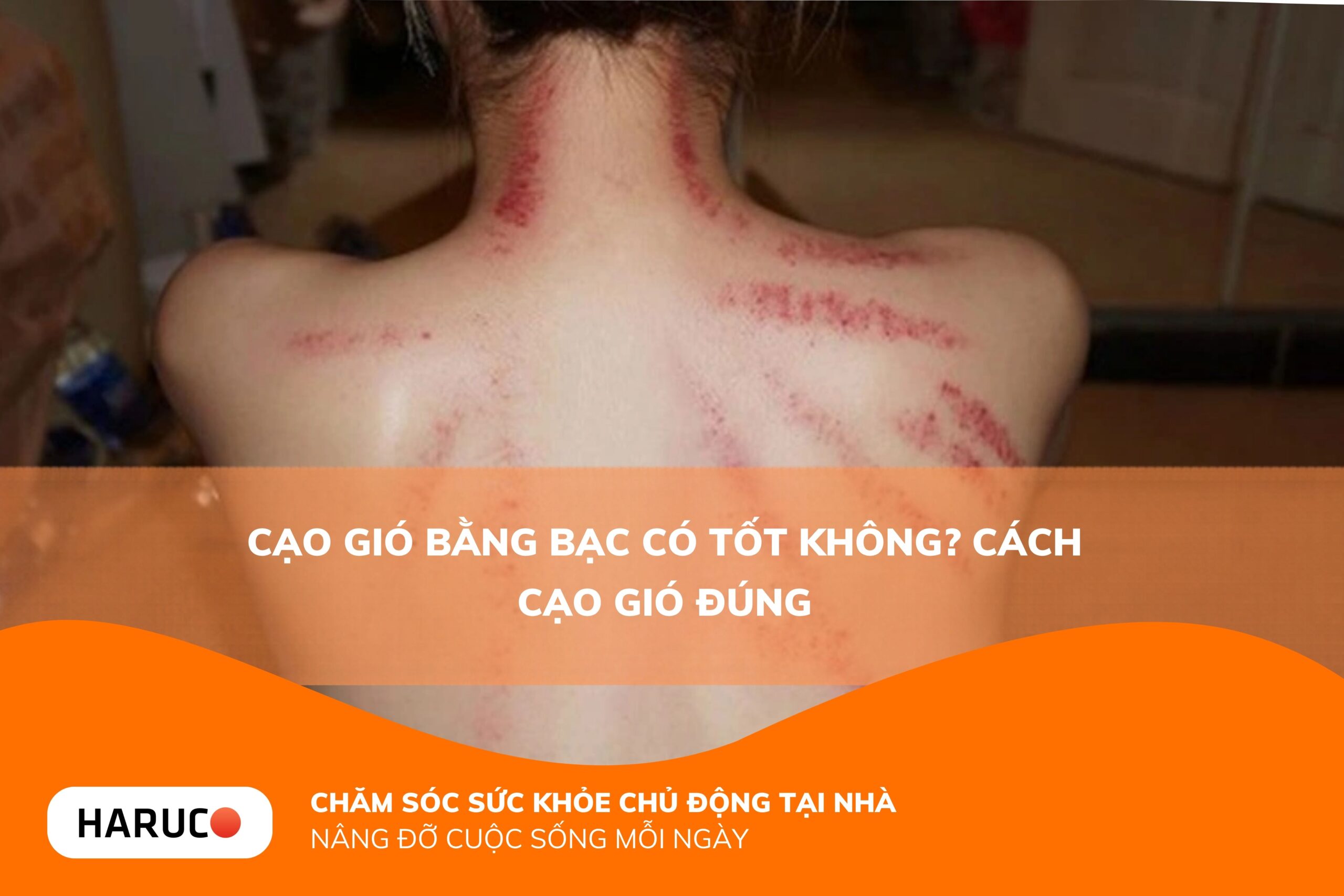 Cạo gió bằng bạc có tốt không? Cách cạo gió đúng