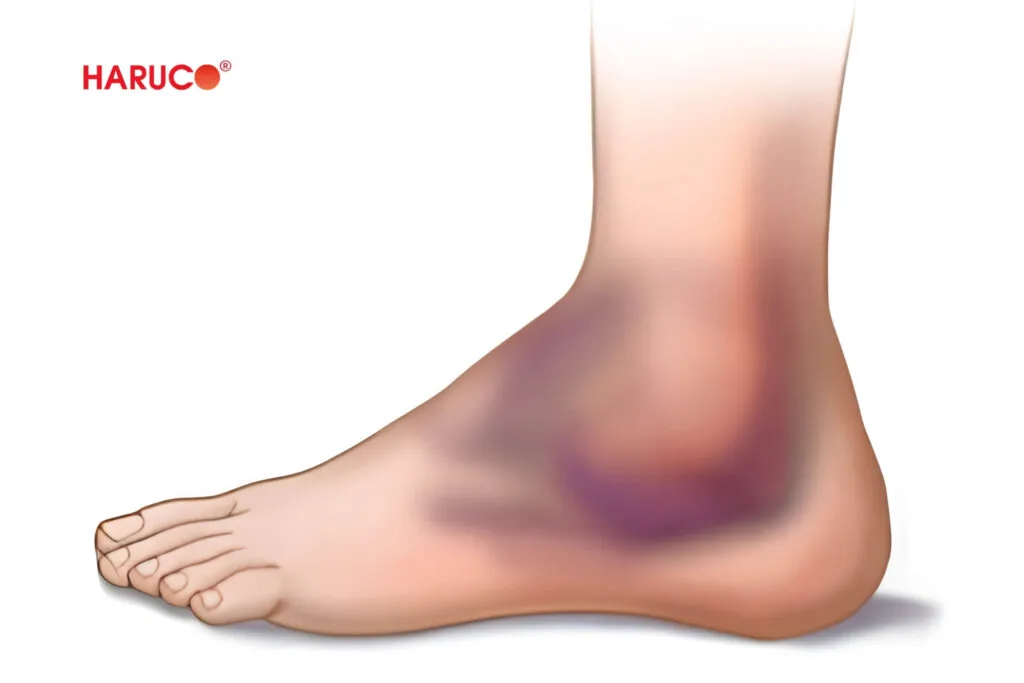 Tác dụng và rủi ro khi bóp rượu gừng