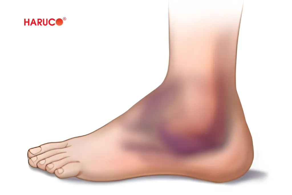 Tác dụng và rủi ro khi bóp rượu gừng