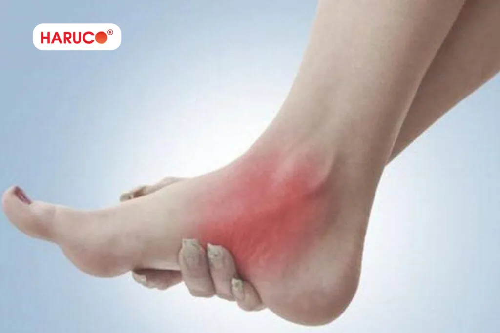 Chăm sóc bong gân đúng cách giúp phục hồi nhanh hơn