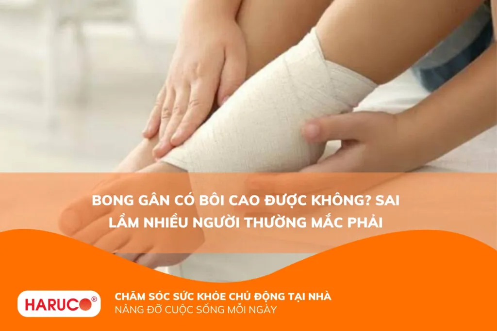 Bong gân có bôi cao được không? Sai lầm nhiều người thường mắc phải