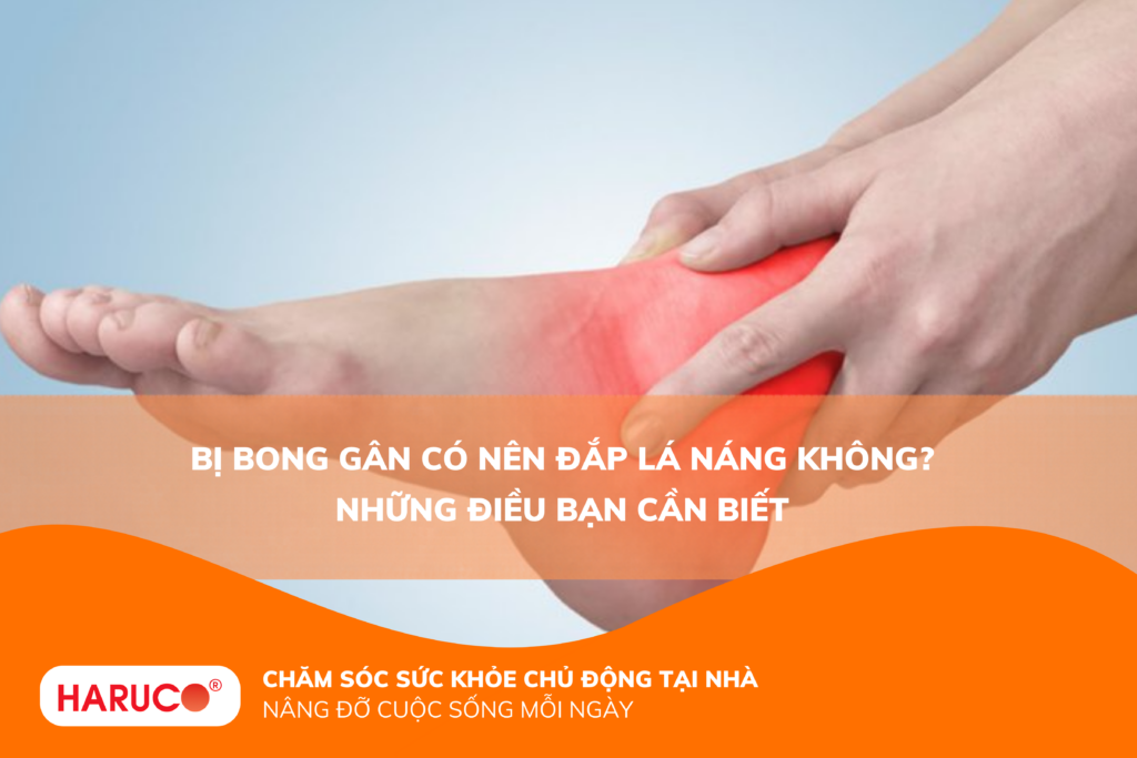Bị bong gân có nên đắp lá náng không? Những điều bạn cần biết