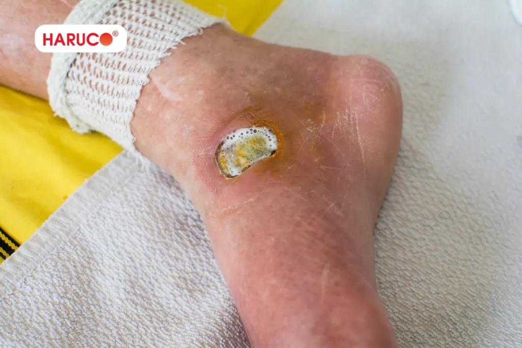 Muối ngâm chân thảo dược: Công dụng và cách dùng hiệu quả