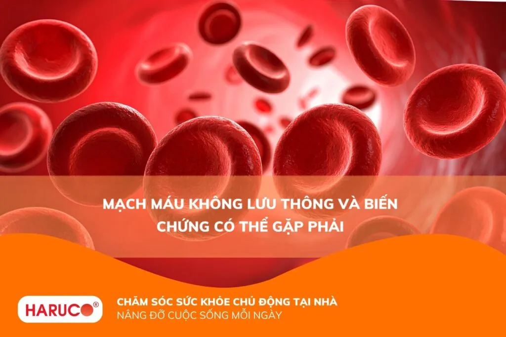 Mạch máu không lưu thông gây ra ảnh hưởng gì cho sức khỏe?