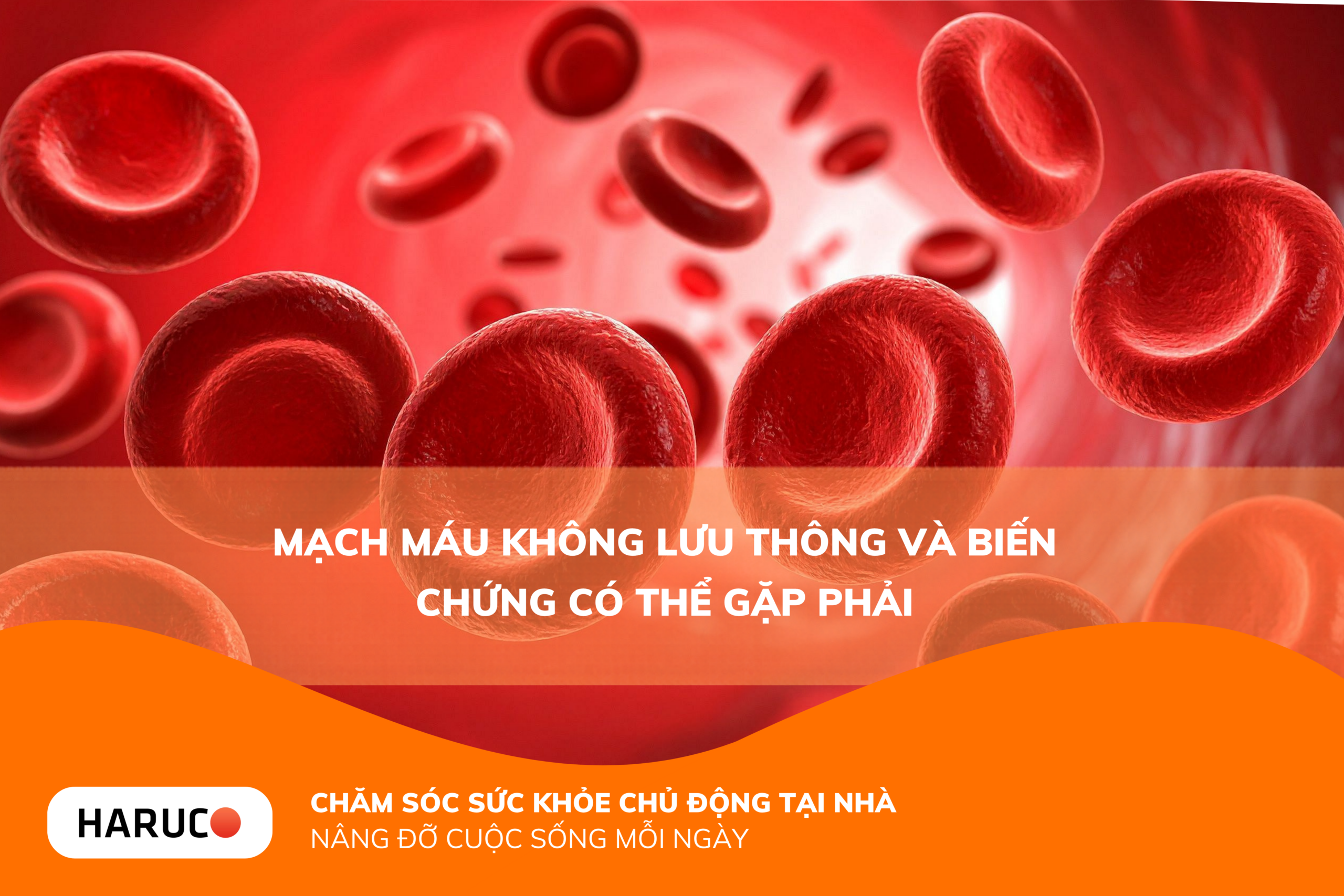 Mạch máu không lưu thông và biến chứng có thể gặp phải
