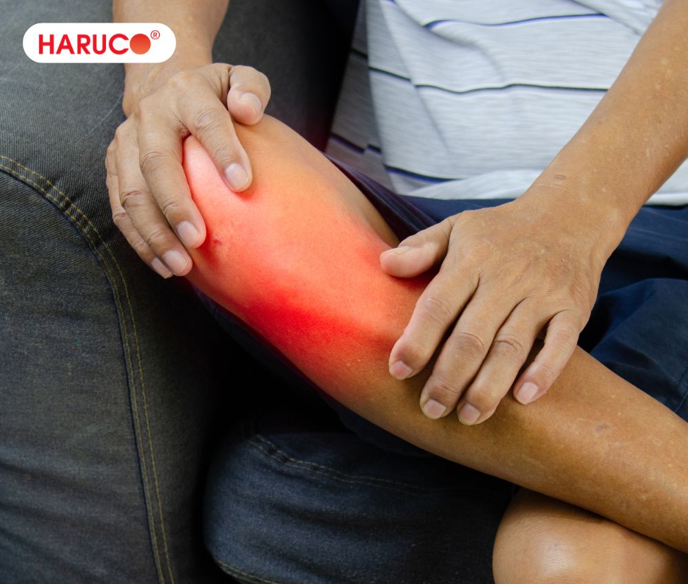 Đau nhức khớp tay, chân là biểu hiện của bệnh phong thấp