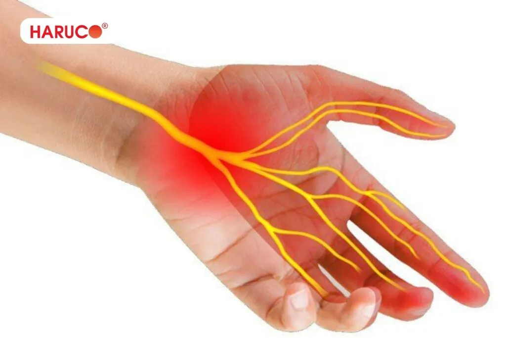 Tổn thương rễ thần kinh sâu khiến tay có cảm giác như kiến bò