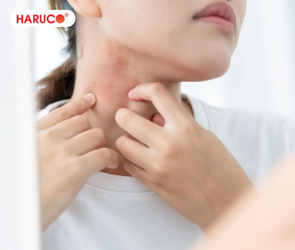 Tắm hoặc xông nước lá ngải cứu giúp làm dịu da, giảm ngứa do mề đay, mẩn ngứa