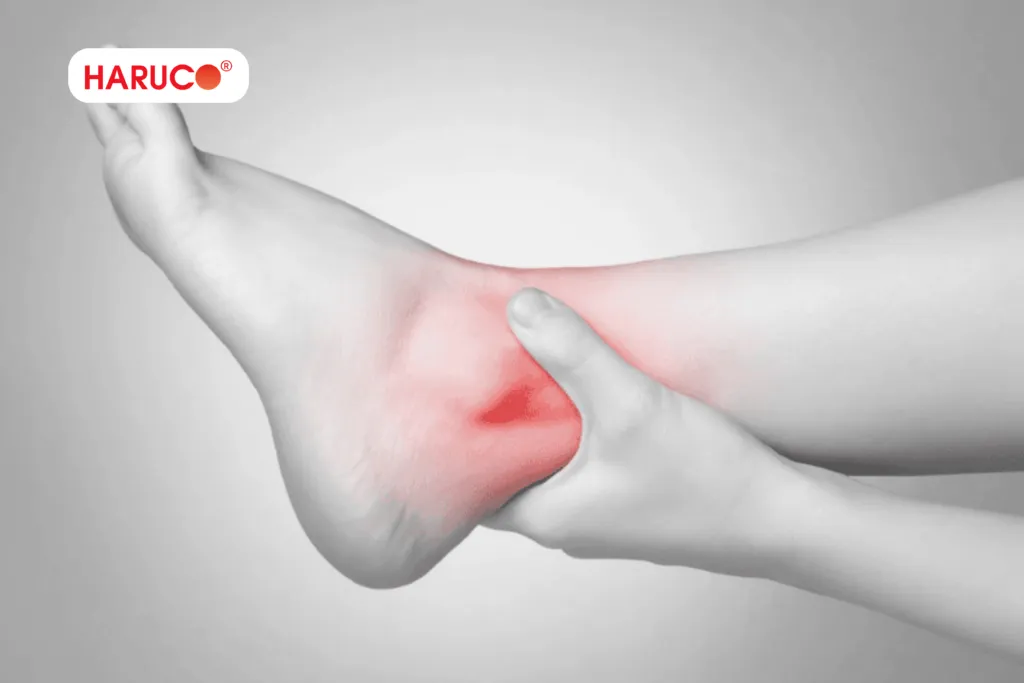Lưu ý chế độ ăn uống cho người bong gân