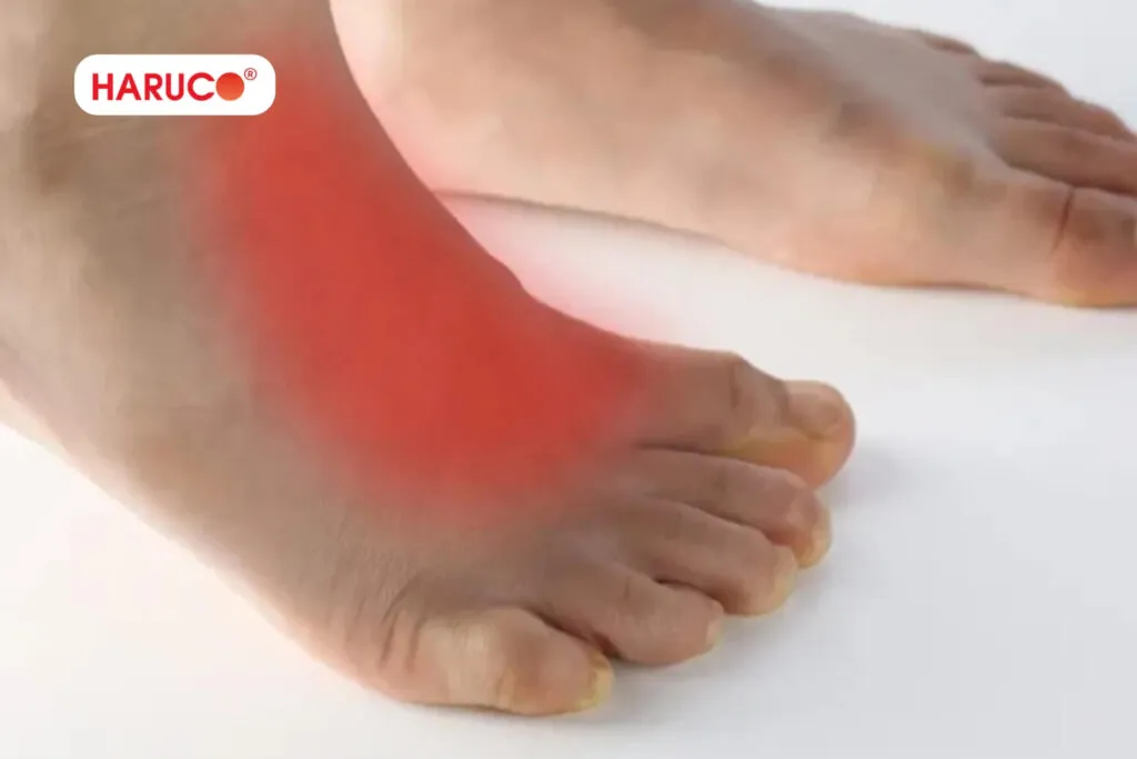 Bong gân bôi dầu được không