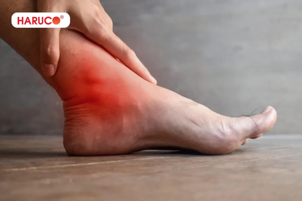 Bong gân bôi rượu thuốc được không? Có thể gây tác dụng phụ, khiến cho tình trạng bong gân càng trở nên nặng nề