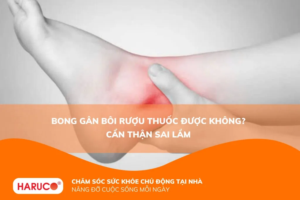 Bong gân bôi rượu thuốc được không? Cẩn thận sai lầm