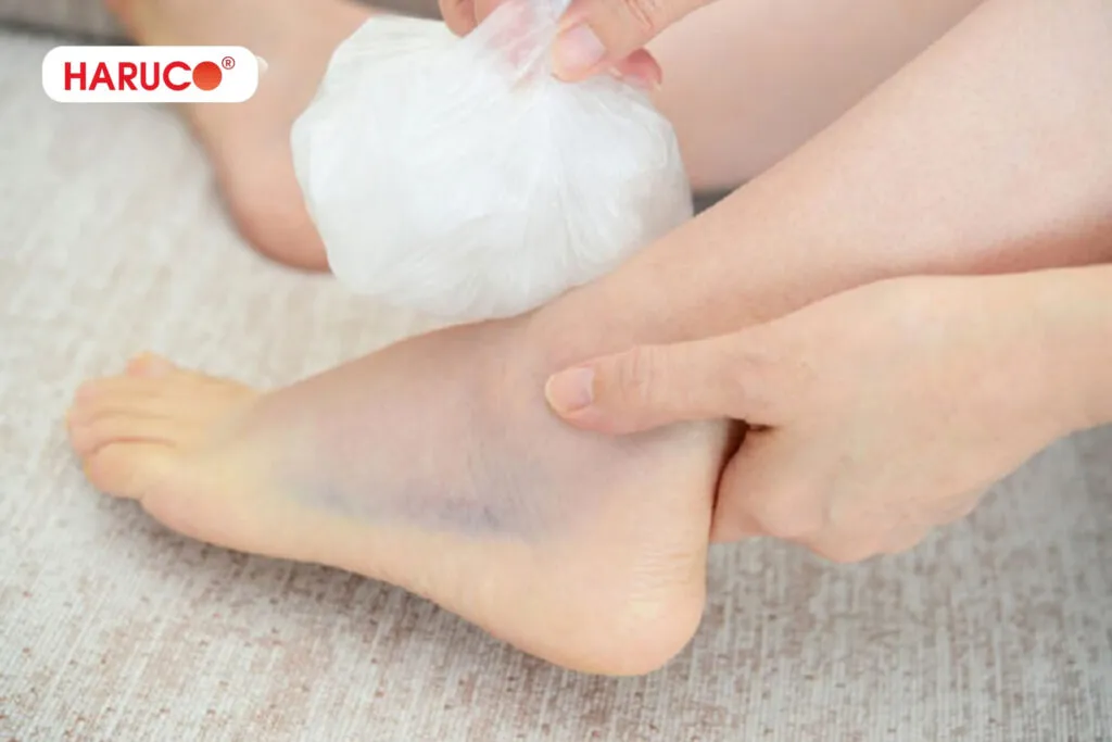 bong gân bôi salonpas được không, có thể làm chậm quá trình hồi phục tự nhiên của dây chằng