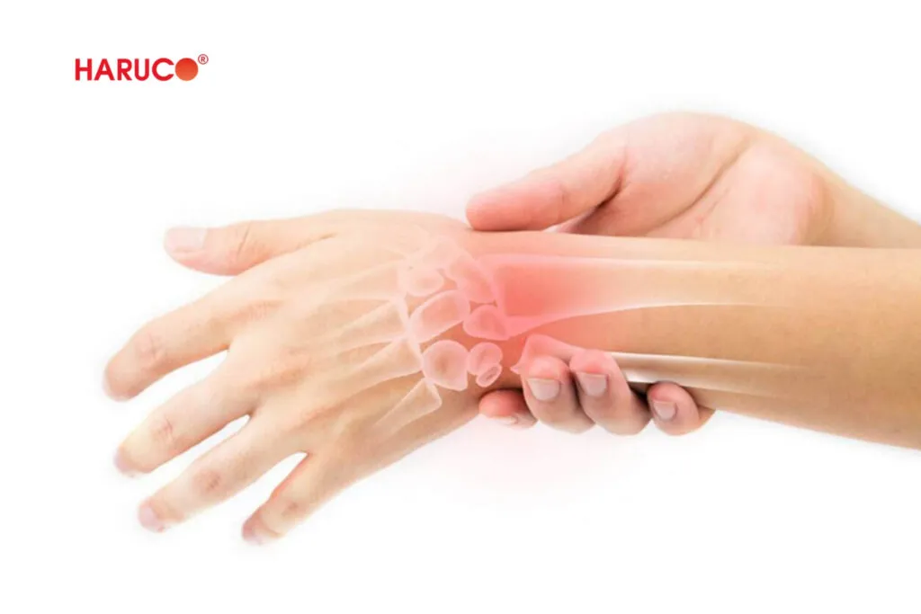 bong gân cổ tay có phải bó bột không, đừng quên việc chụp phim để kiếm tra là vô cùng quan trọng giúp loại bỏ khả năng gãy xương