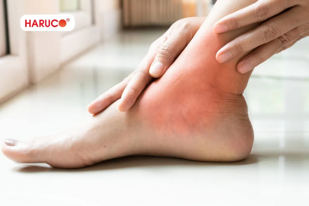 Bong gân đắp muối khi chấn thương do tư thế sai lệch