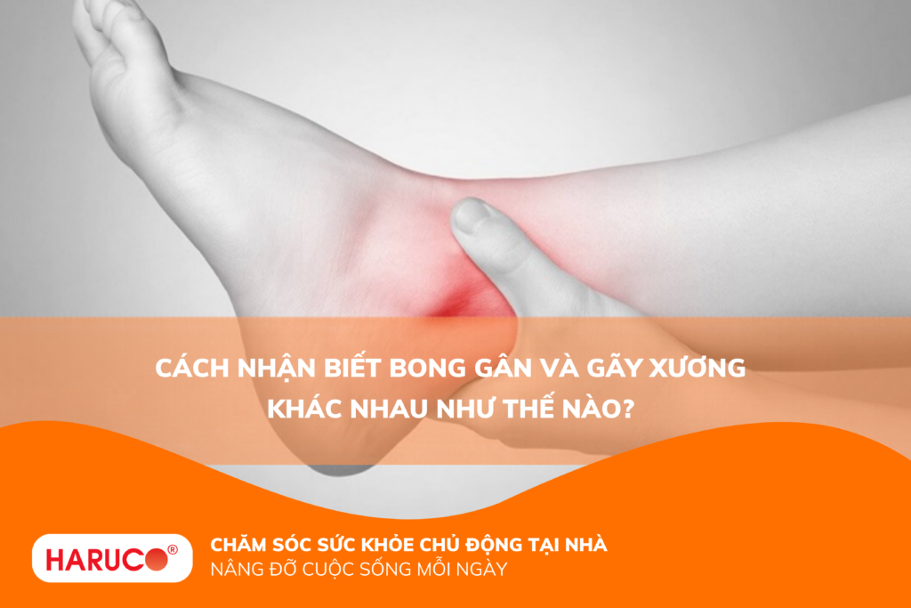 Cách nhận biết bong gân và gãy xương khác nhau như thế nào?