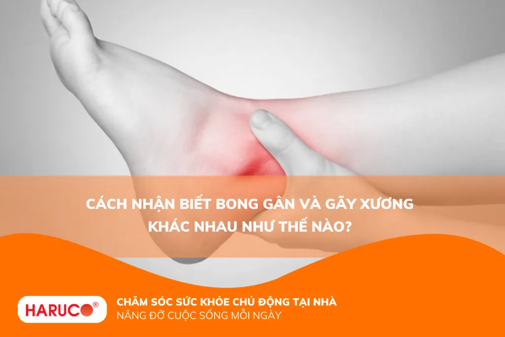 Cách nhận biết bong gân và gãy xương khác nhau như thế nào?