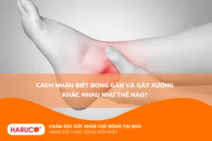 Cách nhận biết bong gân và gãy xương khác nhau như thế nào?