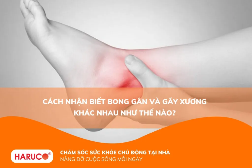 Cách nhận biết bong gân và gãy xương khác nhau như thế nào?