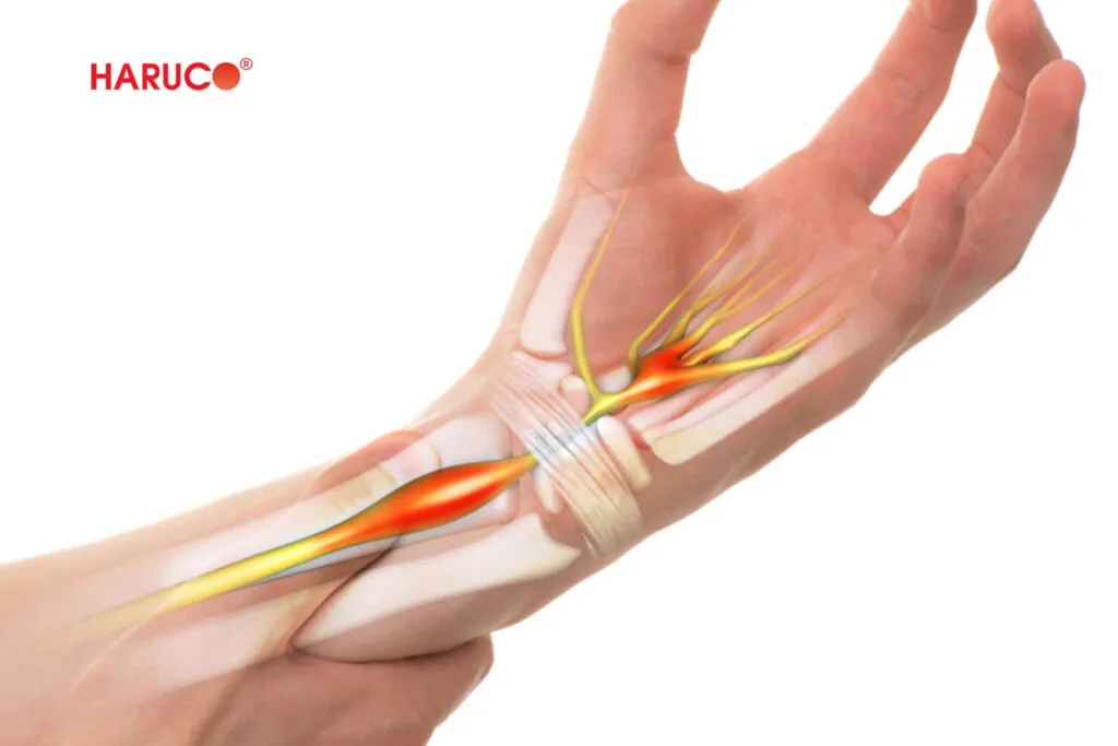 Bong gân với trật khớp cái nào nặng hơn?