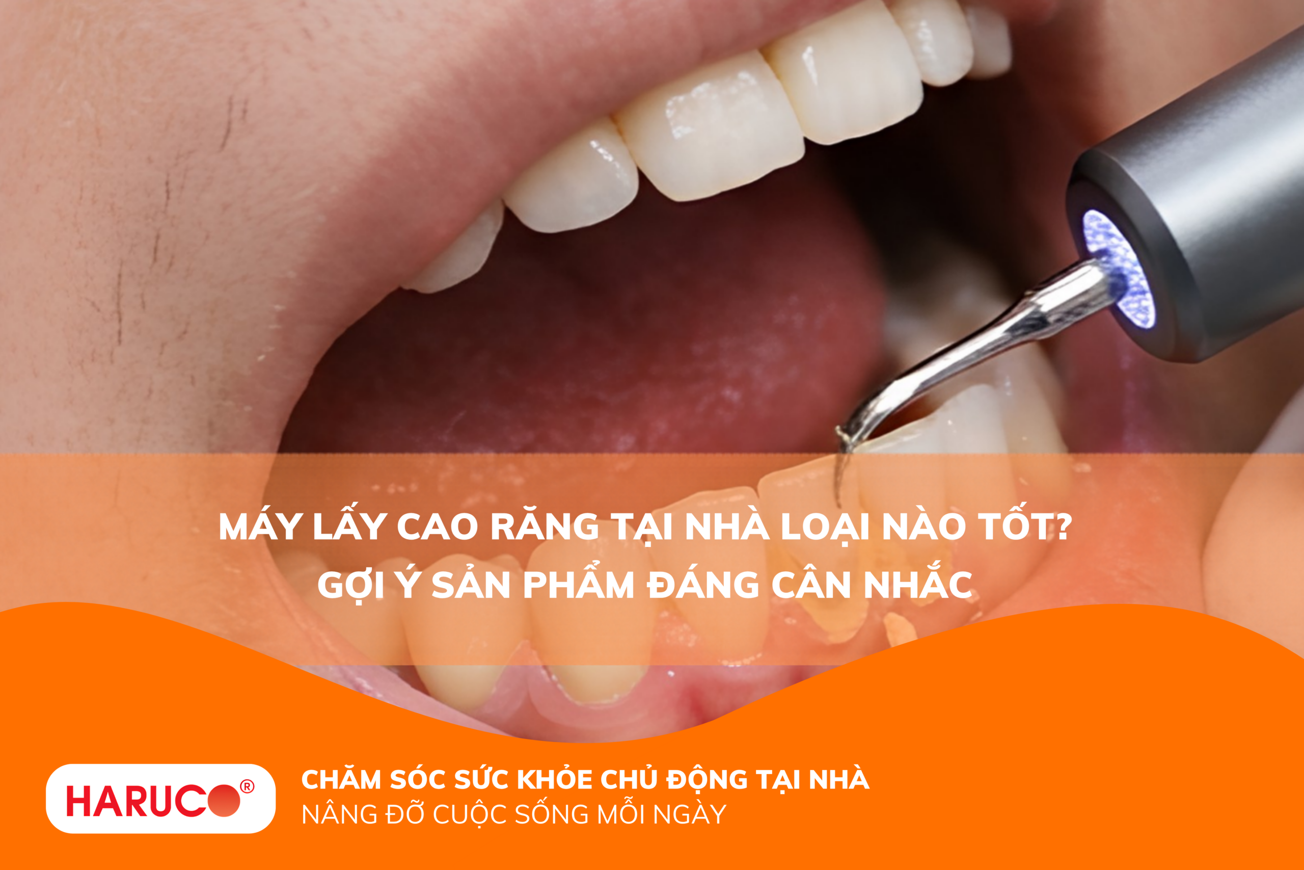 Máy lấy cao răng tại nhà loại nào tốt? Gợi ý sản phẩm đáng cân nhắc