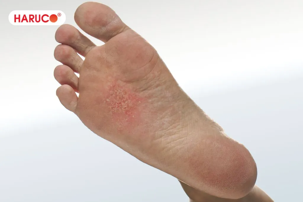 Lưu ý cần nhớ khi xoa dầu gió vào lòng bàn chân