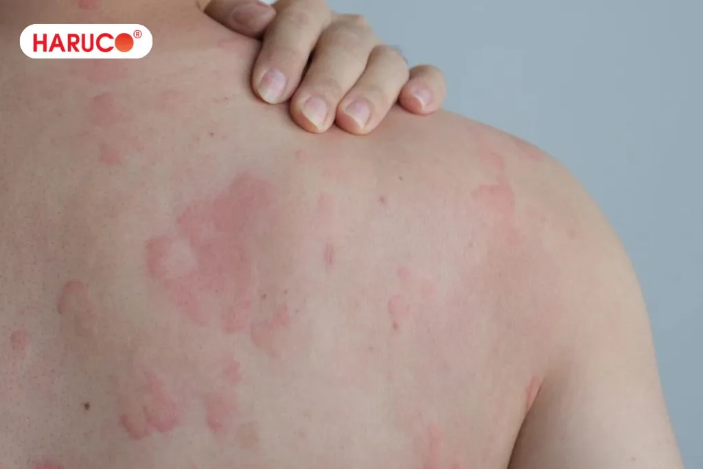 Các trường hợp cần cẩn trọng sử dụng nước lá lốt