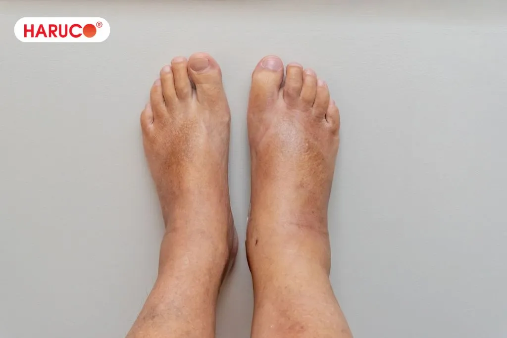 Những dấu hiệu cho thấy bạn có thể đang uống quá nhiều nước