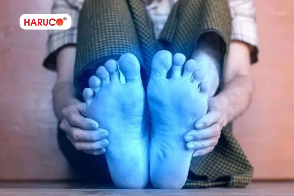 Tại sao lại bị bệnh tay chân lạnh ở phụ nữ?