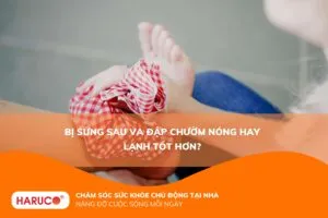 Bị sưng sau va đập chườm nóng hay lạnh tốt hơn?