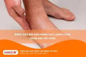 Bong gân bôi dầu nóng hay lạnh? Cách chăm sóc an toàn