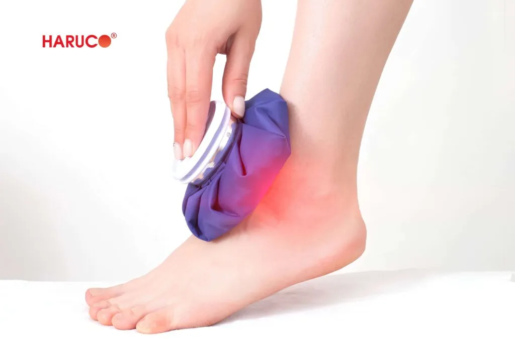 Thời gian chườm đá thay đổi thế nào theo từng giai đoạn bong gân?