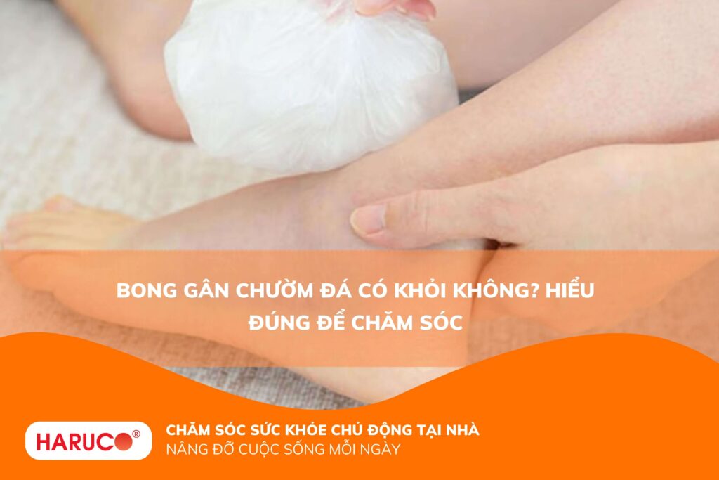 Bong gân chườm đá có khỏi không? Hiểu đúng để chăm sóc