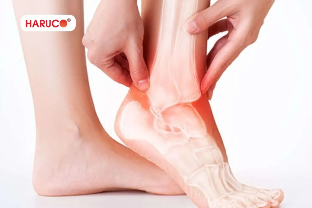 Sau khi bong gân chườm đá cần làm gì để hỗ trợ hồi phục?