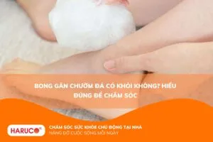 Bong gân chườm đá có khỏi không? Hiểu đúng để chăm sóc