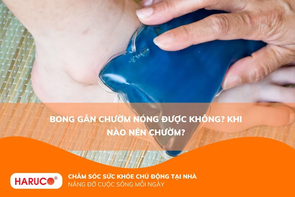 Bong gân chườm nóng được không? Khi nào nên chườm?