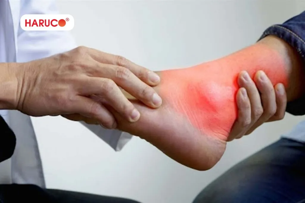 4 tình huống dễ khiến bạn dùng cao nóng sai cách