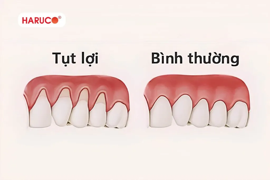 Dấu hiệu dùng tăm nước sai cách cần nhận biết