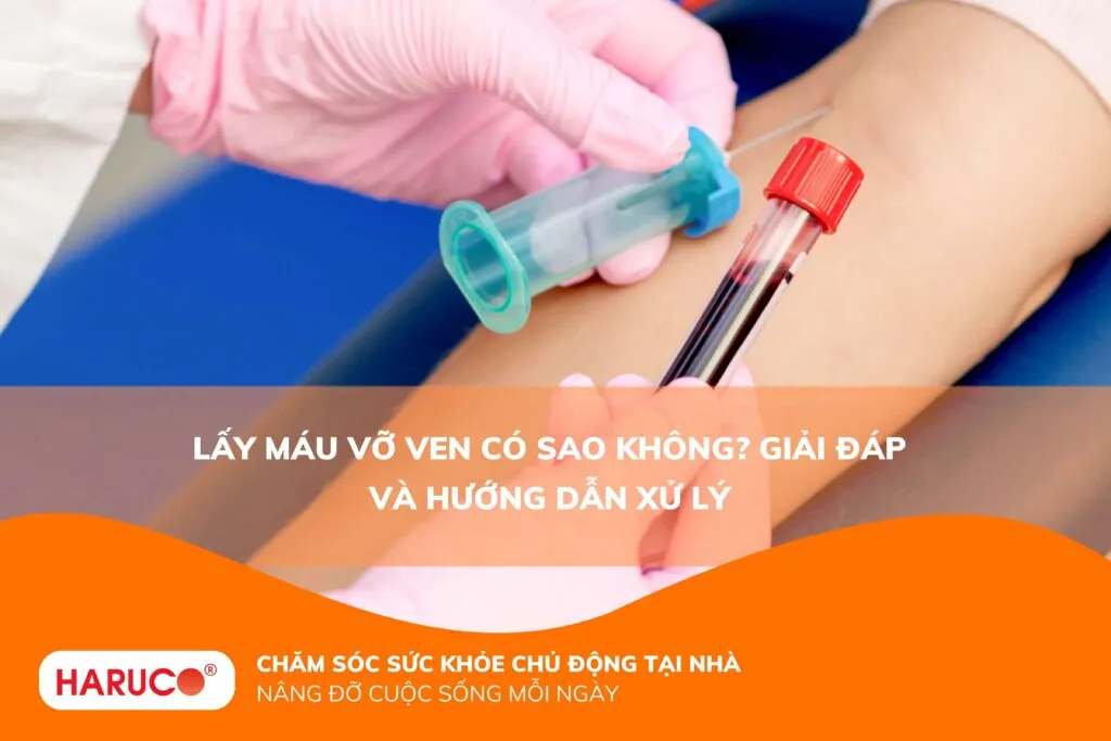 Lấy máu vỡ ven có sao không? Giải đáp và hướng dẫn xử lý