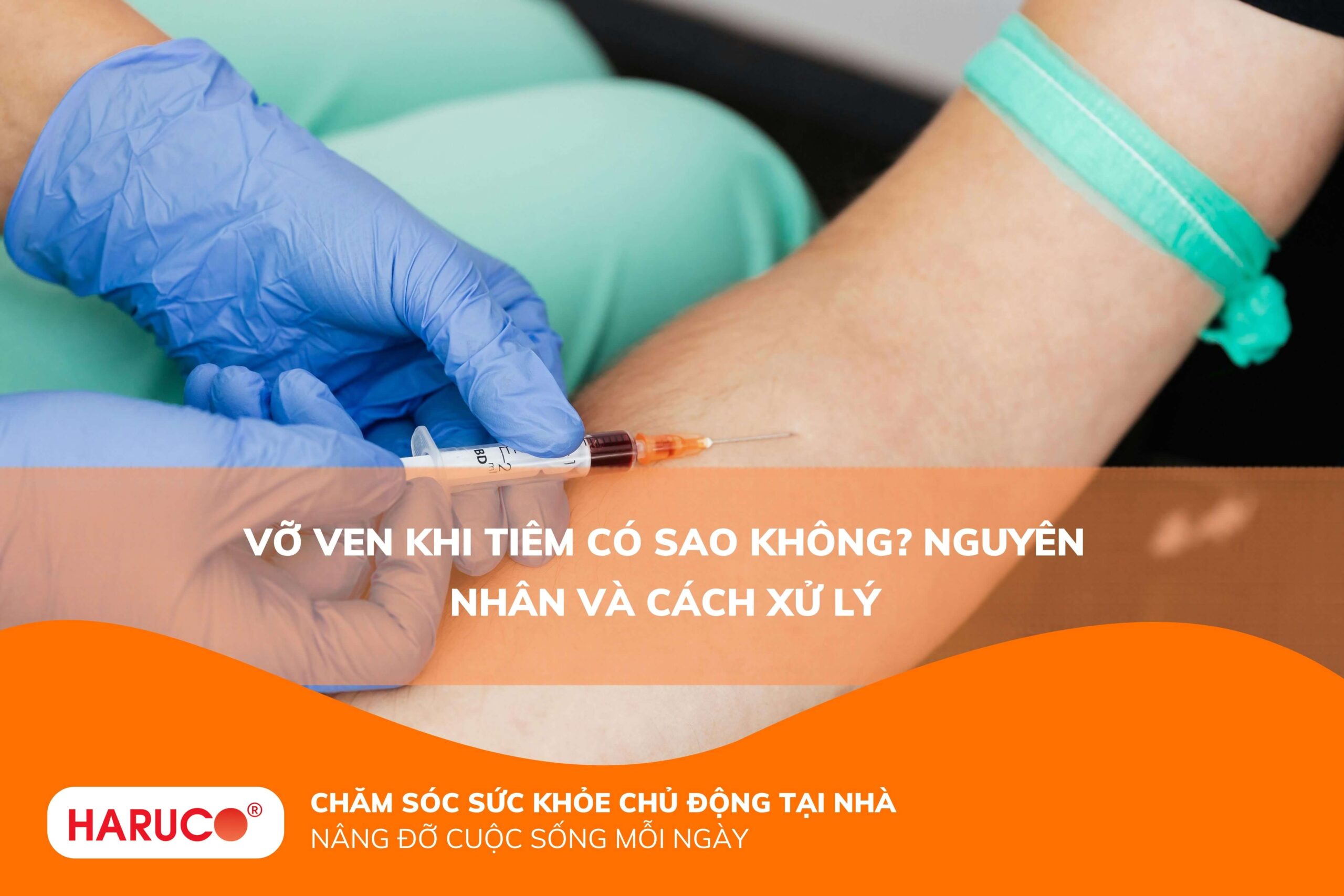 Vỡ ven khi tiêm có sao không? Nguyên nhân và cách xử lý