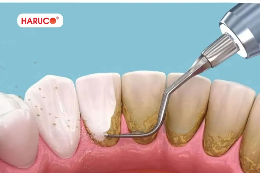 Kết hợp sử dụng lá lốt với biện pháp chăm sóc răng miệng khác