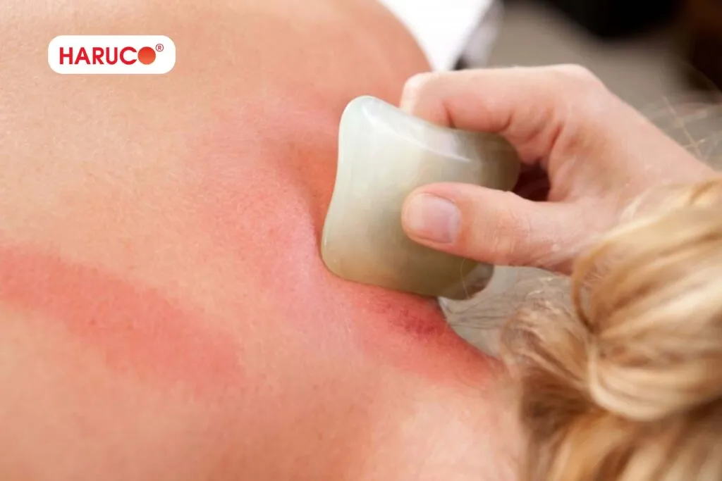 Cách đánh gió bằng dầu gió an toàn tại nhà